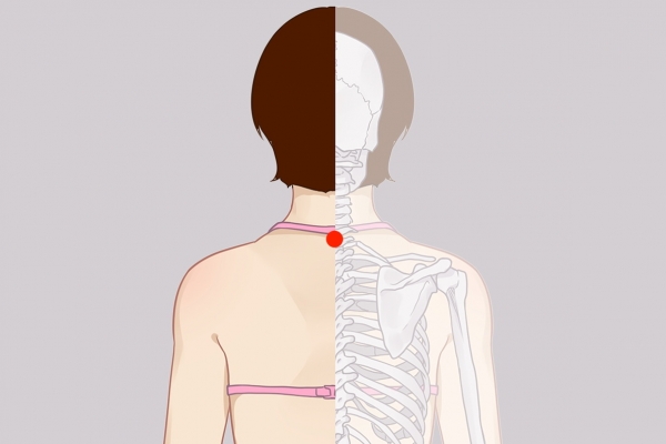 三伏天艾灸哪些部位好点 三伏天适合艾灸的穴位