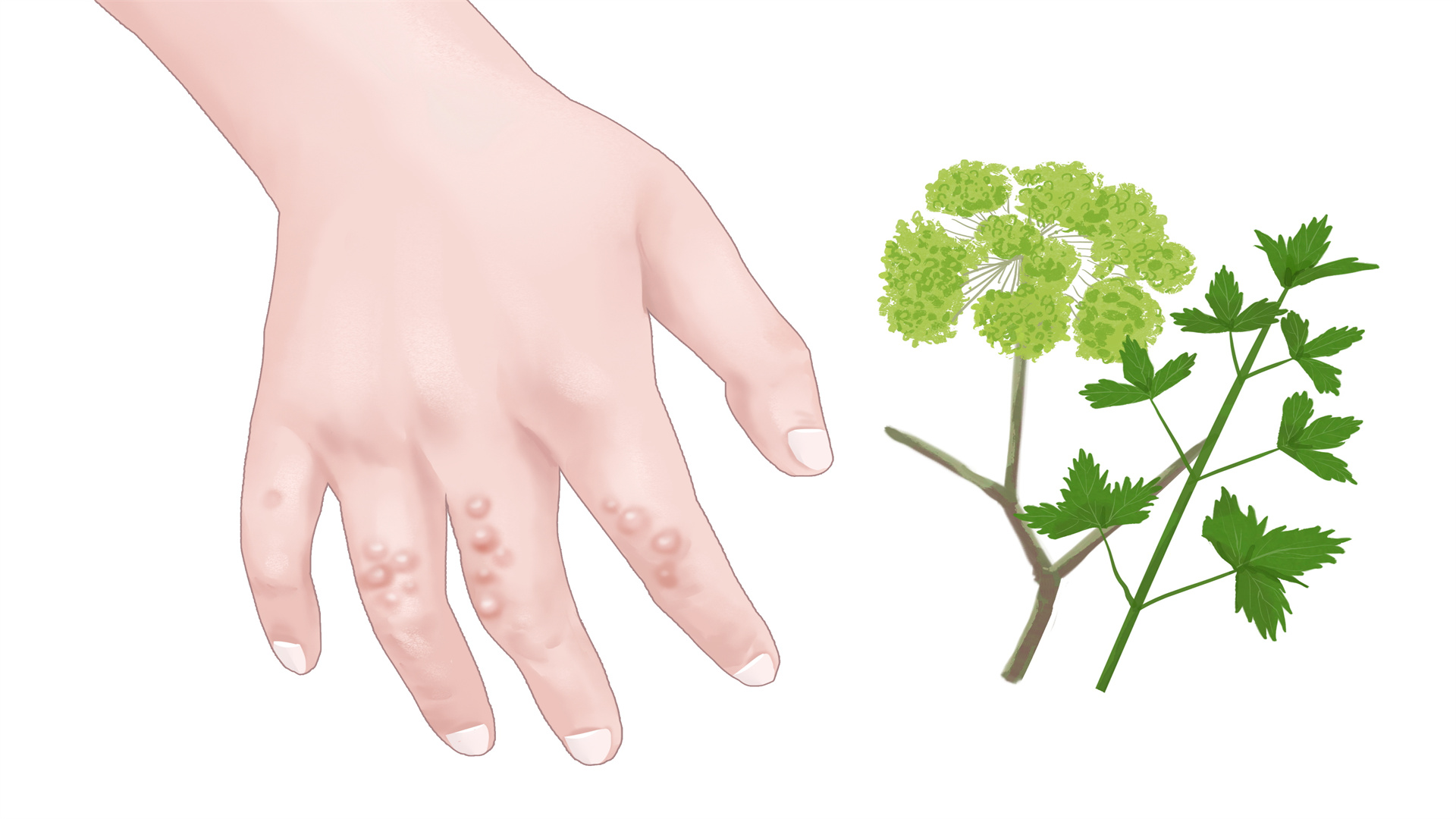 生姜加花椒能祛湿吗？ 祛湿的具体方法