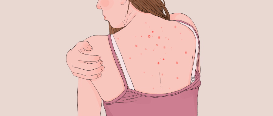 喝祛湿茶要多久有效果 祛湿茶的好处和作用