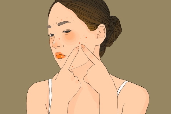 怎么判断自己湿气重不重 人体内湿气重如何解决