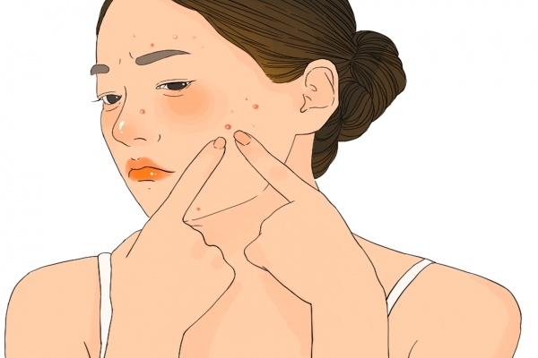 体寒却肝火旺脸上总长痘怎么调理 寒湿脸上长痘还是湿热长痘