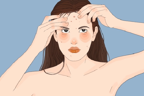 体寒却肝火旺脸上总长痘怎么调理 寒湿脸上长痘还是湿热长痘