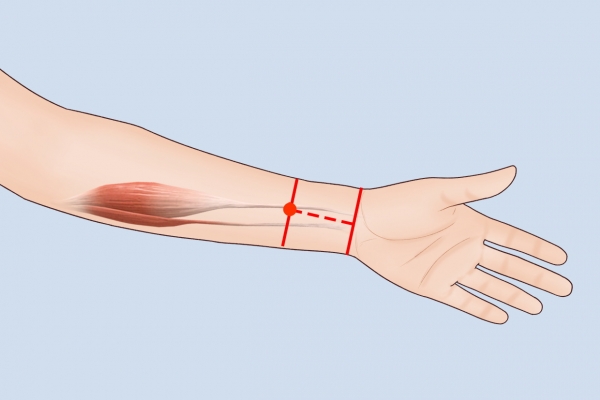 内关穴按摩的好处 按摩内关穴的正确方法