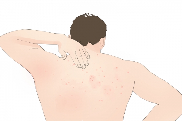 按摩八髎穴的好处 艾灸八髎是补还是泄