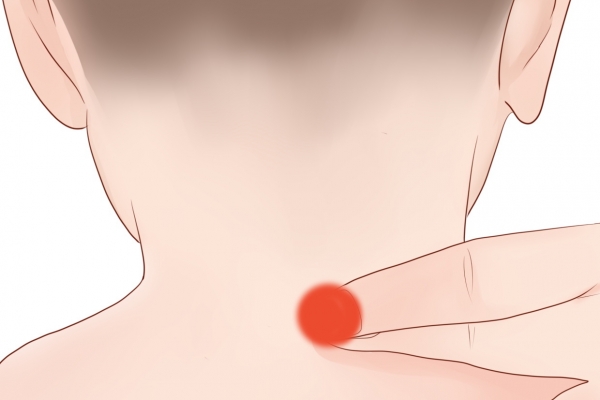 针灸按摩大椎穴的好处 针灸大椎穴有危险吗？