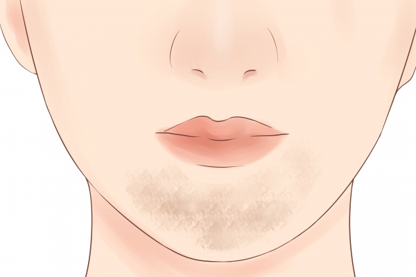 按摩承浆穴的好处 承浆穴在哪里