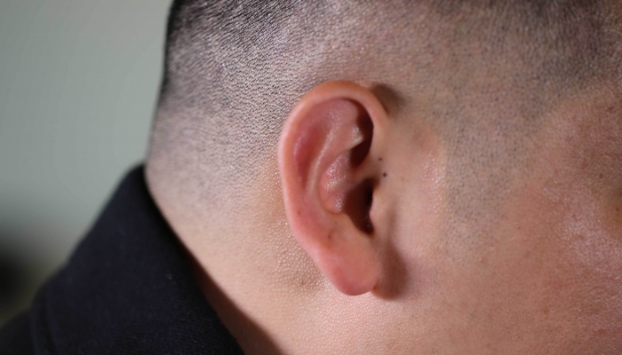 耳垂后面是什么穴位 耳垂后面翳风穴的作用