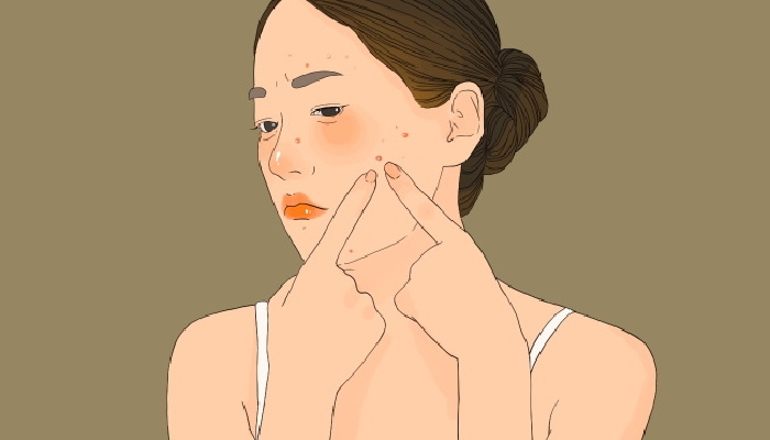 湿气重按什么穴位 湿气重可以怎么调理