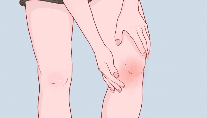 膝盖疼艾灸哪个穴位，哪些人不适合艾灸