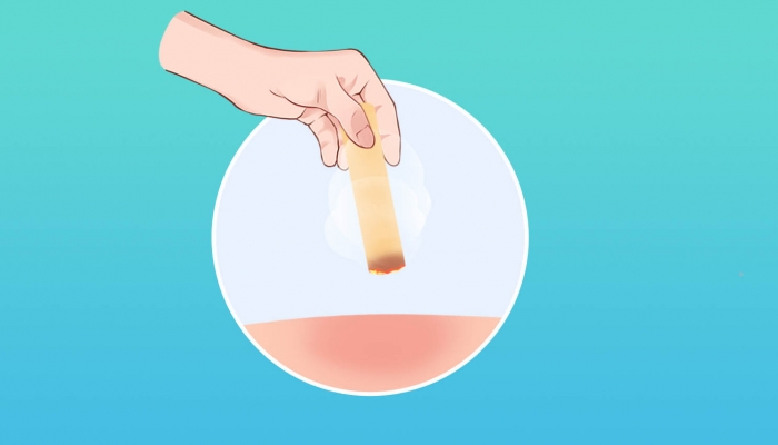 膝盖疼艾灸哪个穴位，哪些人不适合艾灸