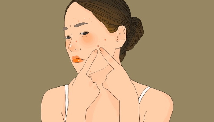 湿气重艾灸哪个穴位 阴虚体质可以艾灸吗？