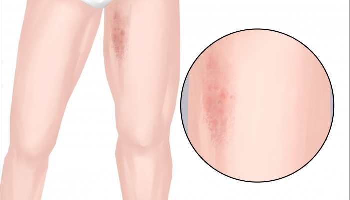 大腿内侧是什么穴位 大腿内侧是啥经络