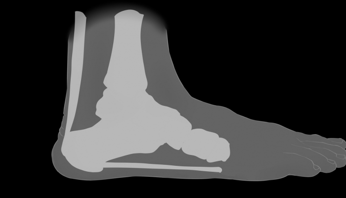 脚踝内侧是什么穴位 刺激穴位时要注意什么