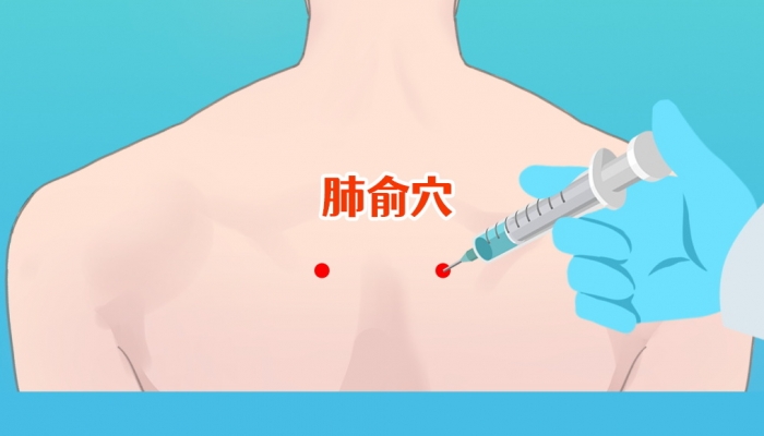 宝宝咳嗽按什么穴位 宝宝咳嗽按摩什么穴位最有效
