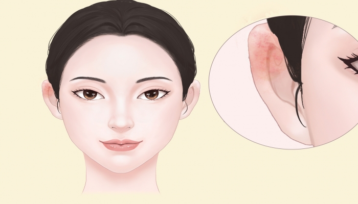 耳朵上面是什么穴位 耳朵上有什么穴位