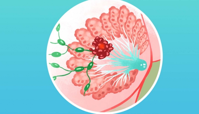 乳腺结节按摩哪个穴位 改善乳腺结节的按摩手法