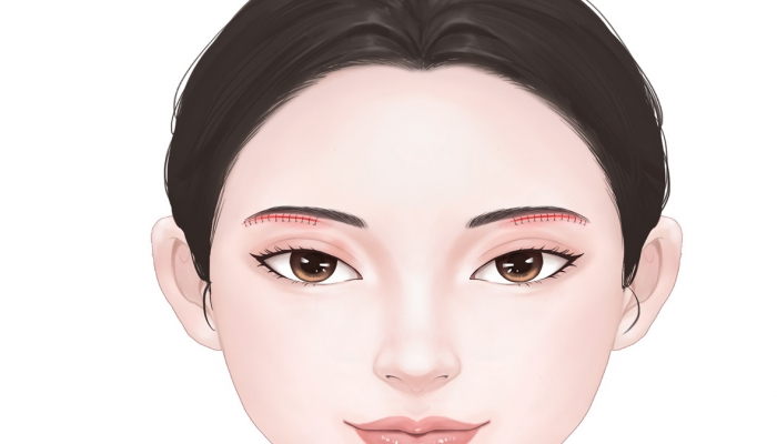 两眉之间是什么穴位 两眉之间叫印堂穴吗？