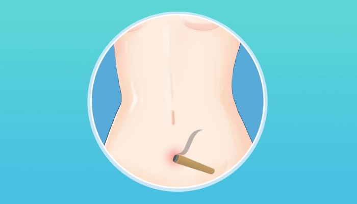 艾灸肚脐眼多久一次最佳 肚脐眼可以艾灸吗？