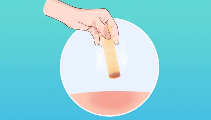 月经期间可以艾灸吗？ 艾灸的十大禁忌