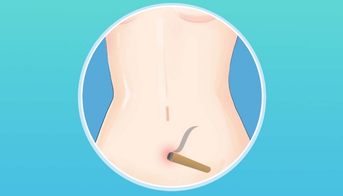 艾灸小腹的好处与功效 艾灸小腹可能的副作用