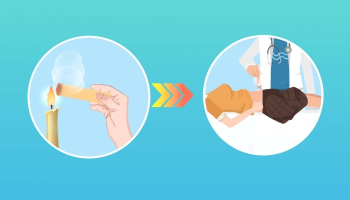 月经期能不能艾灸肚子 艾灸后多久可以碰水