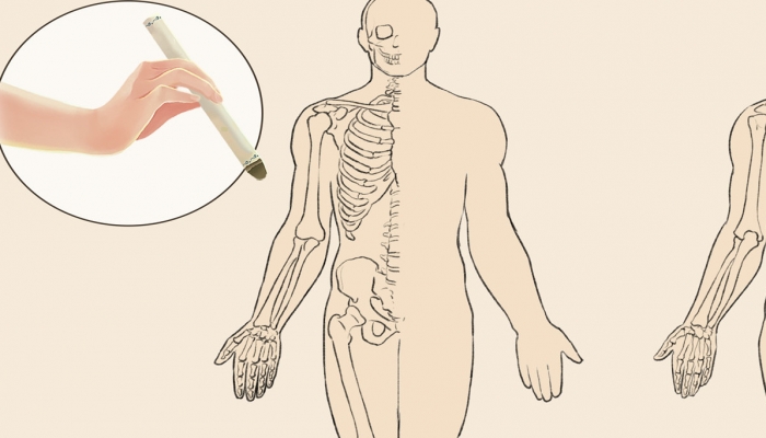 艾灸痒痒的是什么原因 应该如何避免出现痒