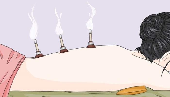 艾灸痒痒的是什么原因 应该如何避免出现痒