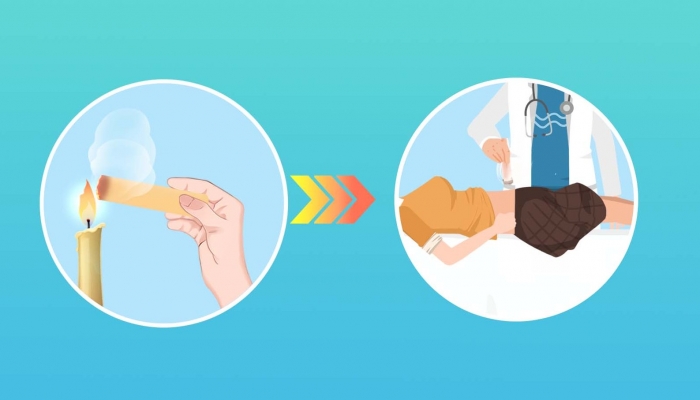 白露痰湿体质艾灸养生有用吗？ 艾灸对痰湿体质的好处