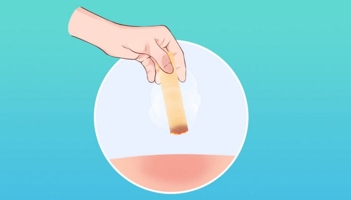 白露艾灸后上火影响养生吗？ 应对上火的方法