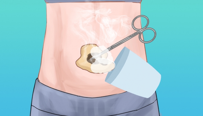 白露阳虚体质艾灸养生有用吗？ 白露阳虚体质艾灸的好处