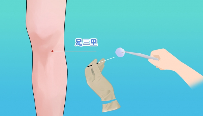 秋分艾灸足三里合适吗？ 秋分艾灸足三里的好处