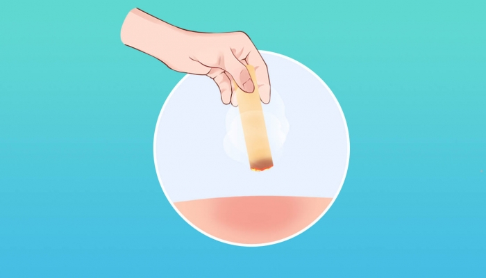 寒露血瘀体质适合艾灸养生吗？ 血瘀体质为什么适合艾灸养生