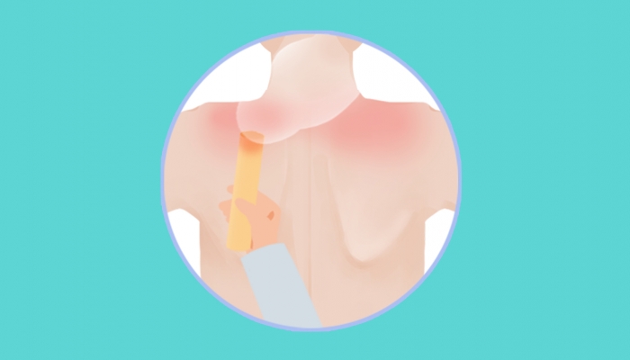 寒露艾灸护肾适合养生吗？ 寒露艾灸护肾的好处